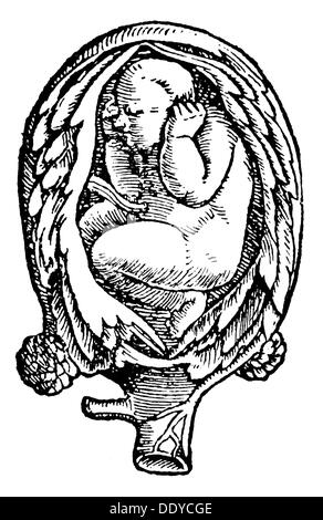Médecine, naissance / gynécologie, position de l'embryon dans l'utérus, coupe de bois, de: Jakob RUF (1505 - 1558), 'Trostbüchlein', imprimer: Christoph Froschauer, Zürich, 1554, droits-supplémentaires-Clearences-non disponible Banque D'Images