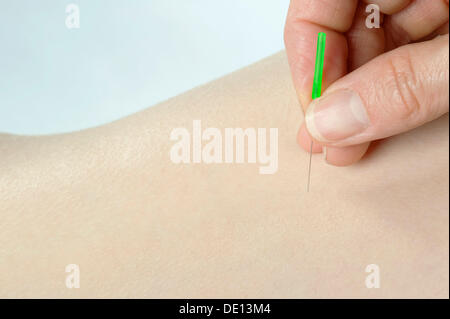 L'acupuncture, le traitement médical, aiguille d'acupuncture Banque D'Images