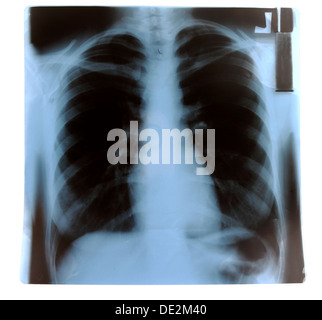 X-ray Banque D'Images