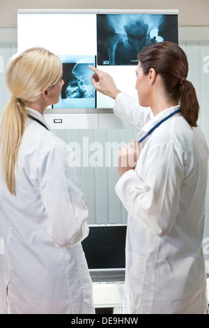 Deux femmes médecins looking at x-rays de remplacement de la hanche et du crâne lors de l'utilisation de portable dans un hôpital Banque D'Images