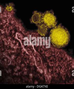 Coronavirus du syndrome respiratoire du Moyen-Orient Banque D'Images