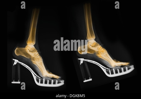 X-ray de pieds dans une paire de chaussures Banque D'Images