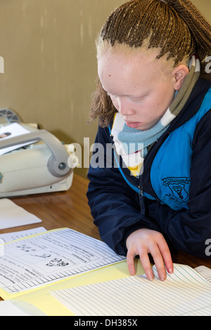 L'Afrique du Sud, Cape Town. Les déficients visuels albinos africains Student Reading Cahier de l'élève. Athlone École pour les aveugles. Banque D'Images