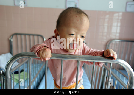 Un bébé avec les mains déformées dans le quartier du Village de la paix de l'hôpital Tu du à Ho Chi Minh Ville. Banque D'Images