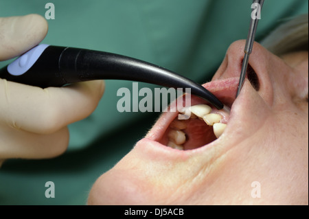 Le nettoyage de la bouche avec un irrigateur oral Banque D'Images