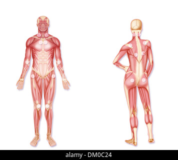 La fibromyalgie, dessin Banque D'Images