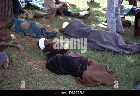 Apr 08, 1994 - Le Burundi, le Rwanda - Les enfants avec machette aux chefs et aux mains de récupérer dans la zone hôpital comme réfugiés Tutsis rwandais fuir de l'autre côté de la frontière, au Burundi en avril 1994, les Hutus commis le génocide dans une guerre civile de 100 jours. Le génocide rwandais a été le meurtre de masse de 1994 on estime que 800 000 personnes dans la petite nation d'Afrique de l'est du Rwanda. Au cours d'env Banque D'Images