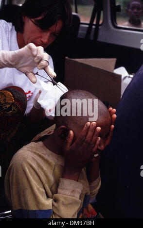 Apr 08, 1994 - Burundi, Rwanda - infirmière de MSF traite de l'woundon vicitm machette rwandaise frontière du Burundi en tant que réfugiés Tutsis rwandais fuir de l'autre côté de la frontière, au Burundi en avril 1994, les Hutus commis le génocide dans une guerre civile de 100 jours. Le génocide rwandais a été le meurtre de masse de 1994 on estime que 800 000 personnes dans la petite nation d'Afrique de l'est du Rwanda. Au cours de approximat Banque D'Images