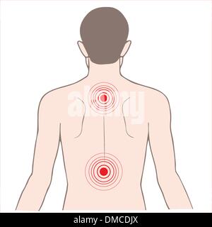 La douleur de dos et de cou Illustration de Vecteur