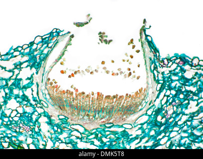 Uromyces pisi photomicrographie, fond clair sur l'Euphorbe ésule Euphorbia cyparissias (Chypre) une tasse de cluster, les spores de la rouille Banque D'Images