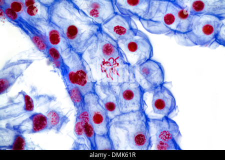 Fond clair photomicrographie. Cellules ovariennes lily montrant la migration des chromosomes au cours de la division, de la reproduction. Les noyaux sont souillés Banque D'Images