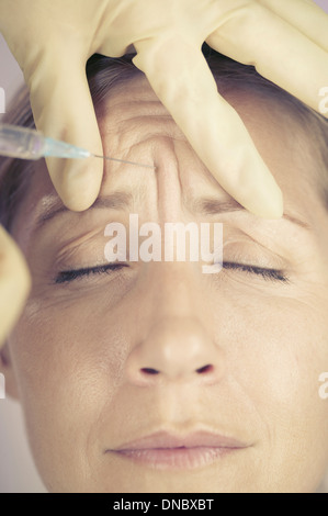 Une femme d'âge moyen ayant une injection de Botox dans le front Banque D'Images