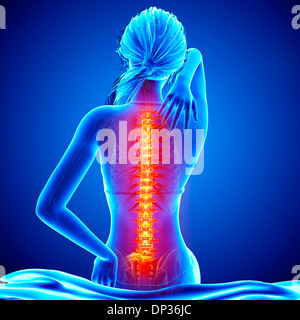 Back pain, artwork Banque D'Images