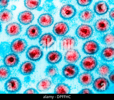 Micrographie électronique à transmission du SIDA, le VIH-1 Banque D'Images