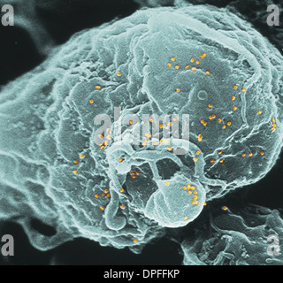 SEM du virus de l'immunodéficience humaine (VIH) Banque D'Images