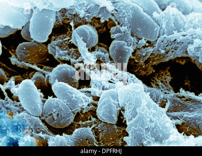 SEM, image de la bactérie Yersinia pestis Banque D'Images
