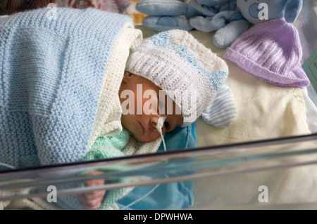 Les nouveau-nés prématurés à l'hôpital bébé lit bébé avec un tube d'alimentation fixé sur son nez Banque D'Images