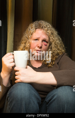 Une femme d'âge moyen avec un œil noir l'air triste et intropsective. Banque D'Images