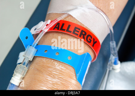 L'hôpital d'un patient atteint d'une allergie et bracelet IV aiguille dans sa main. Banque D'Images