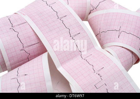 ECG papier graphique avec impulsion de signal isolé sur fond blanc Banque D'Images