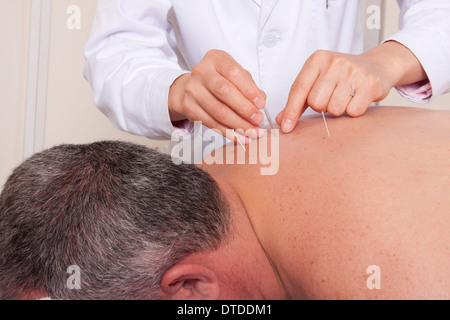 Homme ayant un traitement d'acupuncture pour la douleur de l'épaule et du cou Banque D'Images