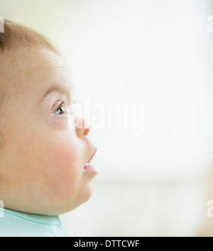 Caucasian baby girl with Down Syndrome Banque D'Images