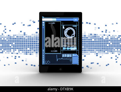 Affichage de l'interface tablette colonne médicale Banque D'Images