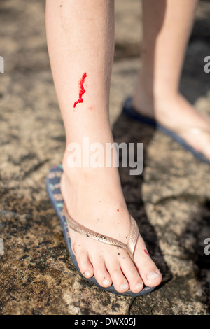 La section basse de fille avec jambe blessée debout sur rock Banque D'Images