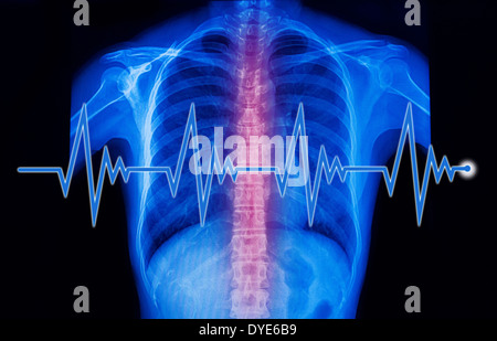 Résumé La santé et milieux médicaux montrant x-ray image et la ligne d'un électrocardiogramme. Banque D'Images