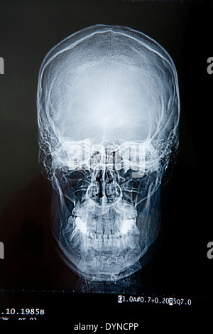 Close up of x-ray de skull Banque D'Images