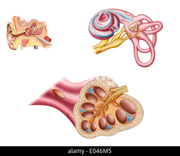 Anatomie de l'implant cochléaire dans le conduit de l'oreille humaine. Banque D'Images
