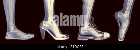 X-ray of a woman's foot dans 4 différents (de gauche à droite) Les formateurs, talon haut, l'exécution et le Ballet Banque D'Images