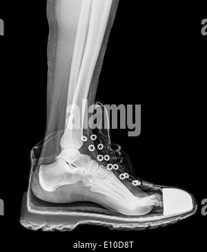 Radiographie d'un pied et la cheville dans une chaussure de course Banque D'Images