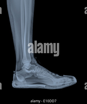 Radiographie d'un pied et la cheville dans un formateur Banque D'Images