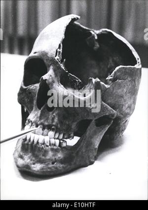 12 déc., 1972 - Nouvelle trace dans le cas de ''Reichseiter'' Martin Bormann ?  : Deux os, un crâne et cuisse supérieure ont été trouvés dans les fouilles à Berlin, Station Lehrt. À cet endroit, Martin Bormann le ''substitute'' d'Adolf Hitler est dit d'être tué sur son vol en 1945. Le parquet de Francfort a envoyé le dentaire moule du leader Nazi à Berlin. La photo montre le crâne avec les dents bien conservée. Banque D'Images
