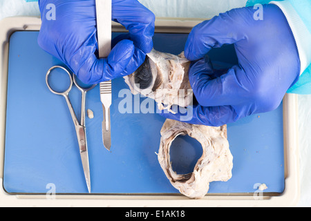 Close up of les mains gantées d'un étudiant la physiologie de l'œil un mouton dissection au scalpel tenant le globe oculaire dans sa main Banque D'Images