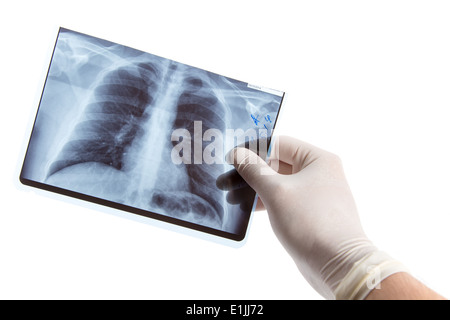 La main des hommes en tenant des gants médicaux, radiographie pulmonaire isolé sur fond blanc Banque D'Images