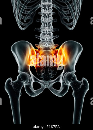 Les droits de l'articulation sacro-iliaque de l'oeuvre de l'ordinateur. Banque D'Images