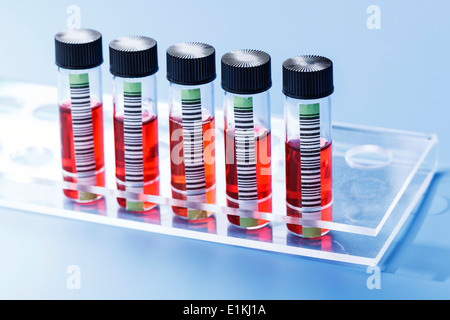 Des échantillons de sang in test tube rack. Banque D'Images