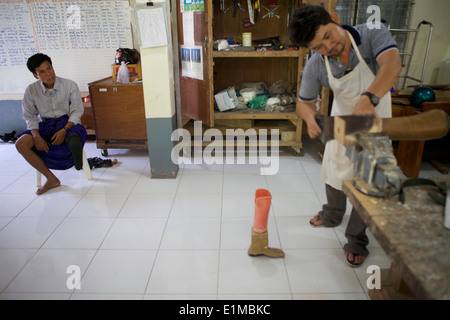 Un homme attend son nouvelle prothèse à la clinique Mae Tao près de la frontière entre la. Bon nombre des personnes ayant besoin de prothèses sont victimes de mines terrestres utilisées depuis des décennies par les militaires birmans contre les minorités ethniques qui vivent le long de la frontière. La clinique Mae Tao fournit des soins médicaux pour les centaines de milliers de réfugiés birmans vivent en ce moment à des camps en Thaïlande. Banque D'Images