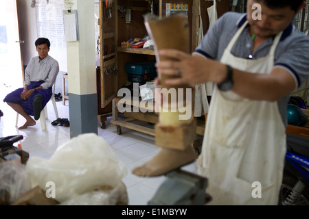 Un homme attend son nouvelle prothèse à la clinique Mae Tao près de la frontière entre la. Bon nombre des personnes ayant besoin de prothèses sont victimes de mines terrestres utilisées depuis des décennies par les militaires birmans contre les minorités ethniques qui vivent le long de la frontière. La clinique Mae Tao fournit des soins médicaux pour les centaines de milliers de réfugiés birmans vivent en ce moment à des camps en Thaïlande. Banque D'Images