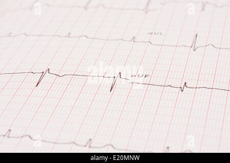 Détail d'un électrocardiogramme Banque D'Images