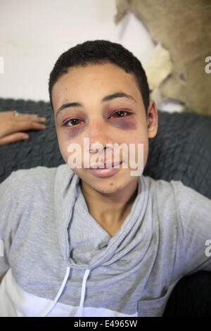 Jérusalem, Israël. 6 juillet, 2014. Tarek Abou Khdeir a finalement été libéré à 14h00 aujourd'hui après son audition devant le Tribunal préliminaire à Jérusalem. Tarek, 15 ans, a été battu et arrêté par les forces de sécurité israéliennes alors qu'il regardait des affrontements entre jeunes Palestiniens et forces israéliennes à Shufat à Jérusalem Est. Tarek a été libéré sous caution sur un 3 000 shekels et il est en résidence surveillée pendant les 10 prochains jours. Tarek et ses parents, Salahedeen et Suha, sont des citoyens américains ; ils étaient en vacances pour rendre visite à leur famille vivant à Jérusalem Est. Credit : Eloïse Bollack/ZUMA/Alamy Fil Live News Banque D'Images