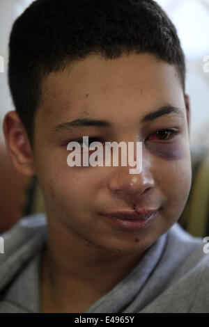 Jérusalem, Israël. 6 juillet, 2014. Tarek Abou Khdeir a été libéré à 14h00 aujourd'hui après son audition devant le Tribunal préliminaire à Jérusalem. Tarek, 15 ans, a été battu et arrêté par les forces de sécurité israéliennes alors qu'il regardait des affrontements entre jeunes Palestiniens et forces israéliennes à Shufat à Jérusalem Est. Tarek a été libéré sous caution sur un 3 000 shekels et il est en résidence surveillée pendant les 10 prochains jours. Tarek et ses parents, Salahedeen et Suha, sont des citoyens américains ; ils étaient en vacances pour rendre visite à leur famille vivant à Jérusalem Est. Credit : Eloïse Bollack/ZUMA/Alamy Fil Live News Banque D'Images