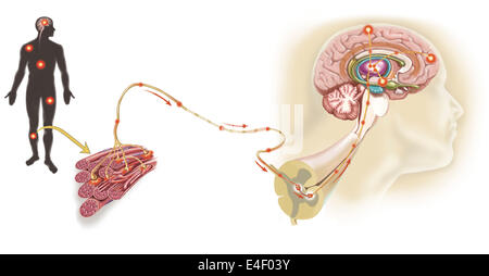 Parcours d'un message via la douleur nerf sensoriel dans le muscle lésé, à la porte de la douleur dans la moelle épinière au système limbique, cortex frontal et Banque D'Images