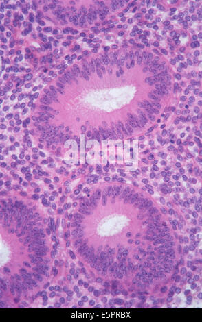 Les cellules de l'endomètre normal, la microscopie. Banque D'Images