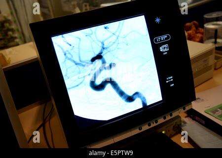 De l'unité de l'hôpital Laennec Nantes, France, spécialisée dans les accidents vasculaires cérébraux (AVC), la surveillance de l'écran de contrôle Banque D'Images