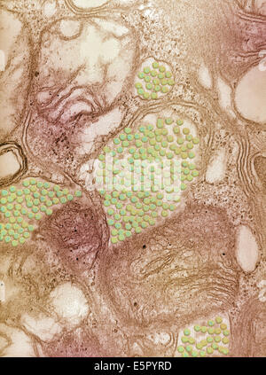 Colorized micrographie électronique à transmission (TEM) de l'encéphalite équine de l'Est (EEE) les virus à partir d'une glande salivaire d'un Banque D'Images