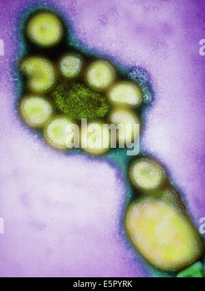 Micrographe de couleur (MET) de Hong Kong les virus influenza (grippe) ,le grossissement : X54,000 à 6x4,50cm taille. Banque D'Images