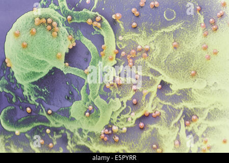 Couleur de l'analyse des électrons Microphotographie du virus VIH (points rouges) à partir d'un bourgeonnement T-lymphocyte globules blancs (jaune et vert). Banque D'Images